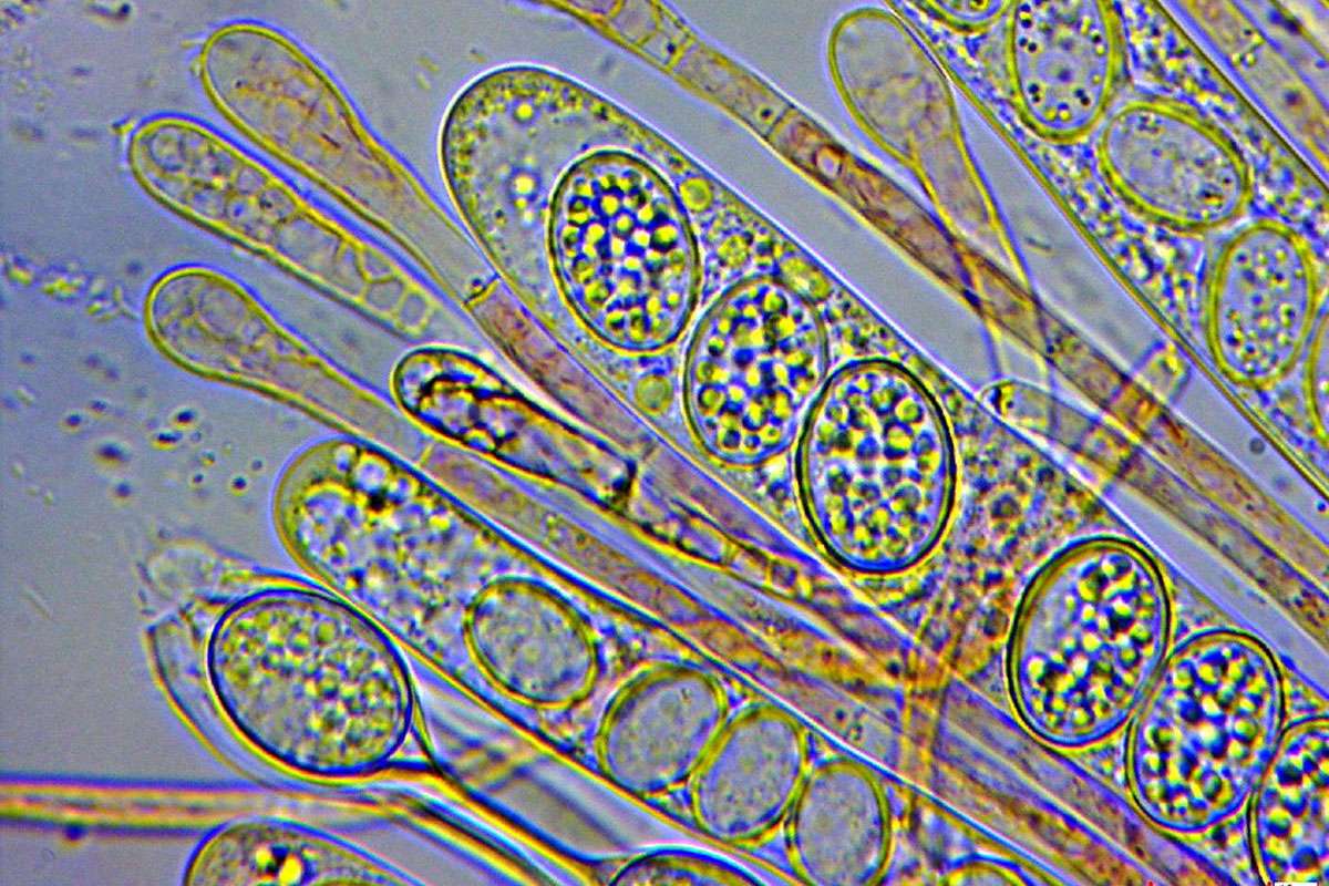 Asci mit Sporen und Paraphysen, Bewimperter Schildborstling (Scutellinia crin, (c) Chris Engelhardt/NABU-naturgucker.de